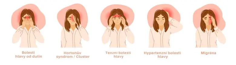 Ilustrace různých typů bolesti hlavy s českými popisky.