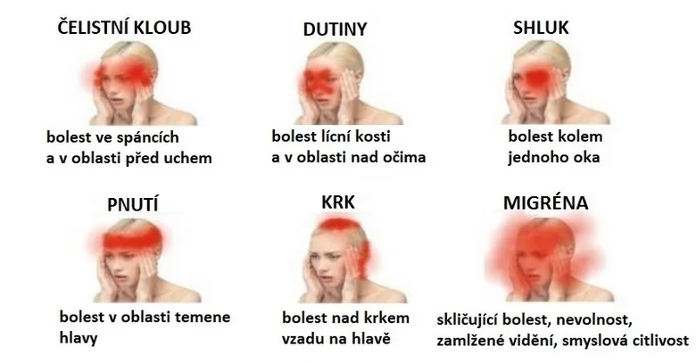 Infografika o typech bolesti hlavy a jejich příčinách v češtině.