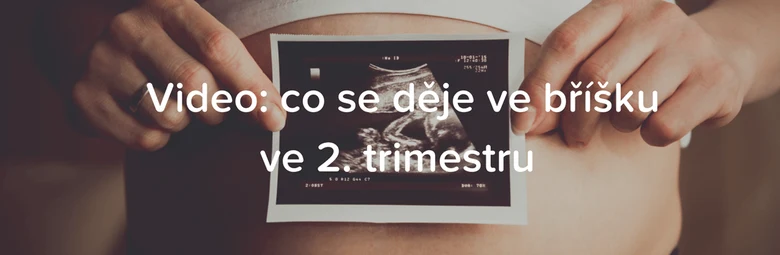 Těhotná žena drží ultrazvukový snímek na svém břiše.