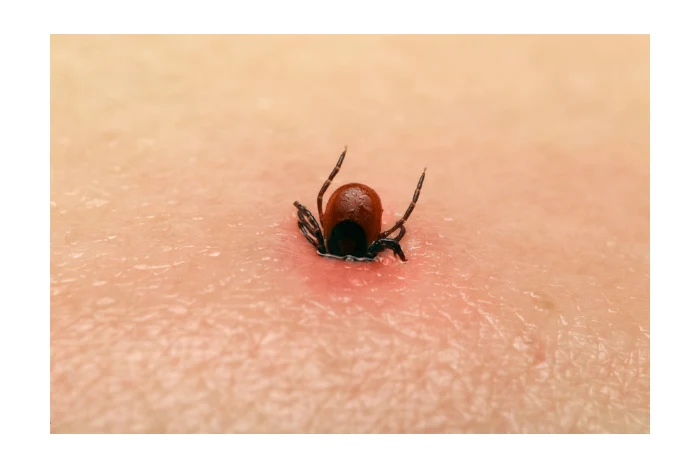 Tick on human skin
