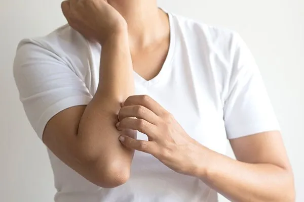 Person scratching arm
