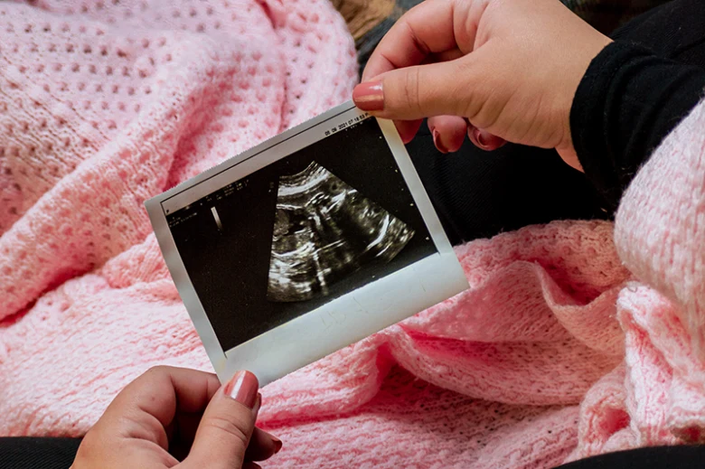 Rukou drží tištěný ultrazvukový snímek plodu v růžovém šátku.