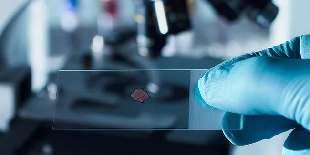 Ruka drží mikroskopický preparát s biologickým vzorkem.